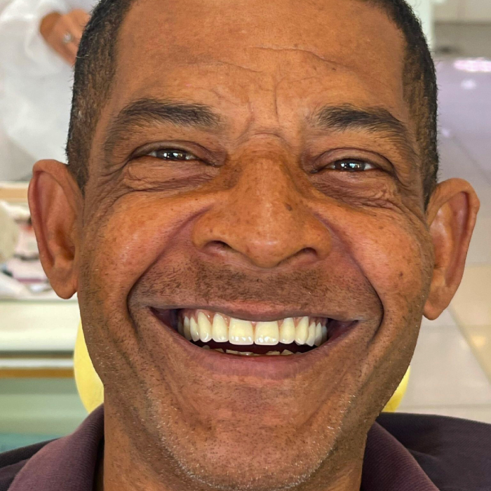 Implantes dentários em Franca SP